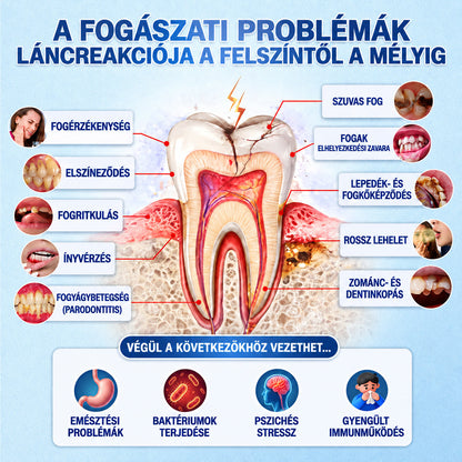 🇭🇺👨‍⚕️✅GarageLine®🦷🍃Ragyogtasd fel a mosolyod✨ Professzionális Fogfehérítő Tapasz 🍃5️⃣