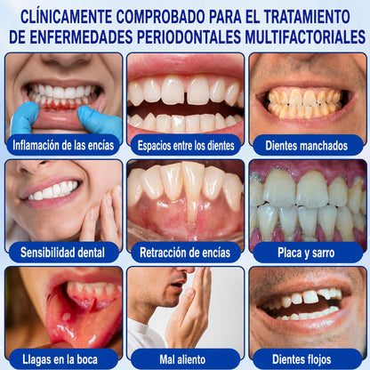 🇪🇸👨‍⚕️✅🦷 HEATWOLF® GumRevive – Gel reparador periodontal🦷✨2️⃣