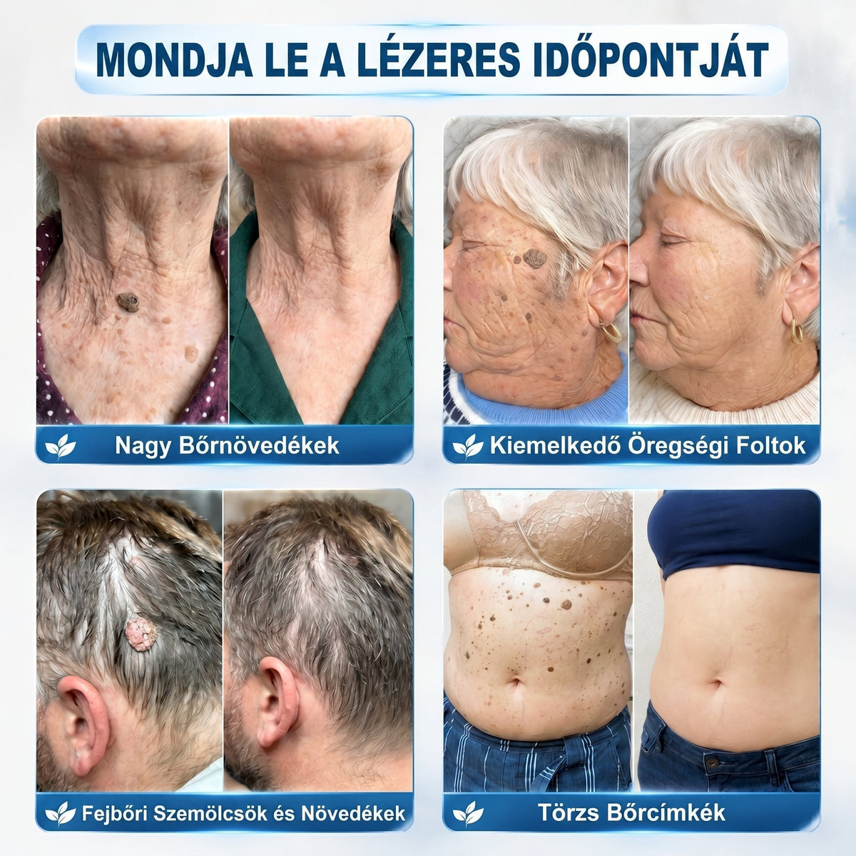 🇭🇺👨‍⚕️🖋️𝐇𝐢𝐯𝐚𝐭𝐚𝐥𝐨𝐬 𝐦á𝐫𝐤𝐚𝐛𝐨𝐥𝐭  Creawel®   𝟕 𝐍𝐚𝐩𝐨𝐬 𝐁ő𝐫𝐤𝐢𝐧ö𝐯é𝐬- é𝐬 𝐅𝐨𝐥𝐭𝐫𝐚𝐝í𝐫(Fájdalommentes, nyommentes roll-on)🖋️🌕2️⃣7️⃣