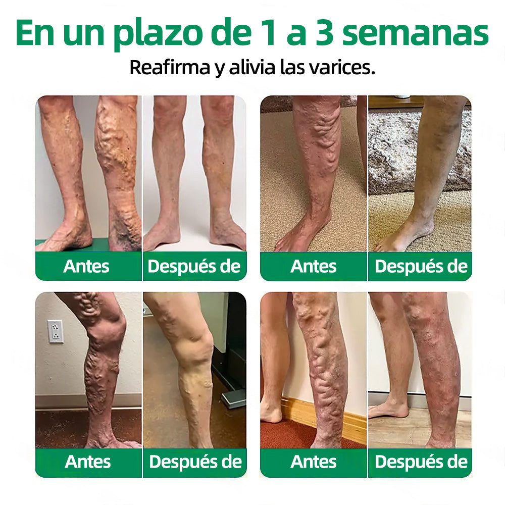 🦵🦵🦵Parche de Microagujas Healrize® VeinTarget —— Alivio Instantáneo, Resultados a Largo Plazo