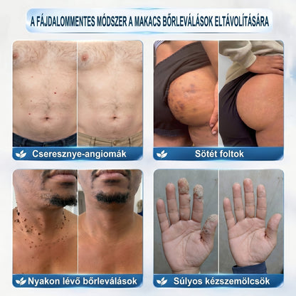 🇭🇺👨‍⚕️🖋️𝐇𝐢𝐯𝐚𝐭𝐚𝐥𝐨𝐬 𝐦á𝐫𝐤𝐚𝐛𝐨𝐥𝐭  Creawel®   𝟕 𝐍𝐚𝐩𝐨𝐬 𝐁ő𝐫𝐤𝐢𝐧ö𝐯é𝐬- é𝐬 𝐅𝐨𝐥𝐭𝐫𝐚𝐝í𝐫(Fájdalommentes, nyommentes roll-on)🖋️🌕2️⃣7️⃣