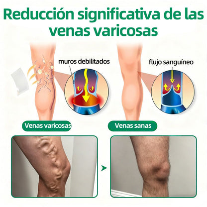 🦵🦵🦵Parche de Microagujas Healrize® VeinTarget —— Alivio Instantáneo, Resultados a Largo Plazo