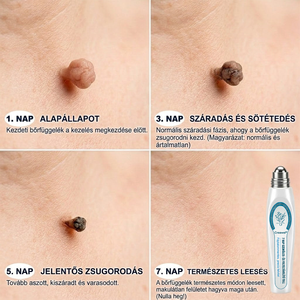 🇭🇺👨‍⚕️🖋️𝐇𝐢𝐯𝐚𝐭𝐚𝐥𝐨𝐬 𝐦á𝐫𝐤𝐚𝐛𝐨𝐥𝐭  Creawel®   𝟕 𝐍𝐚𝐩𝐨𝐬 𝐁ő𝐫𝐤𝐢𝐧ö𝐯é𝐬- é𝐬 𝐅𝐨𝐥𝐭𝐫𝐚𝐝í𝐫(Fájdalommentes, nyommentes roll-on)🖋️🌕2️⃣7️⃣