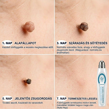 🇭🇺👨‍⚕️🖋️𝐇𝐢𝐯𝐚𝐭𝐚𝐥𝐨𝐬 𝐦á𝐫𝐤𝐚𝐛𝐨𝐥𝐭  Creawel®   𝟕 𝐍𝐚𝐩𝐨𝐬 𝐁ő𝐫𝐤𝐢𝐧ö𝐯é𝐬- é𝐬 𝐅𝐨𝐥𝐭𝐫𝐚𝐝í𝐫(Fájdalommentes, nyommentes roll-on)🖋️🌕2️⃣7️⃣