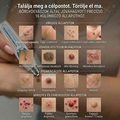 🇭🇺👨‍⚕️🖋️𝐇𝐢𝐯𝐚𝐭𝐚𝐥𝐨𝐬 𝐦á𝐫𝐤𝐚𝐛𝐨𝐥𝐭  Creawel®   𝟕 𝐍𝐚𝐩𝐨𝐬 𝐁ő𝐫𝐤𝐢𝐧ö𝐯é𝐬- é𝐬 𝐅𝐨𝐥𝐭𝐫𝐚𝐝í𝐫(Fájdalommentes, nyommentes roll-on)🖋️🌕2️⃣7️⃣
