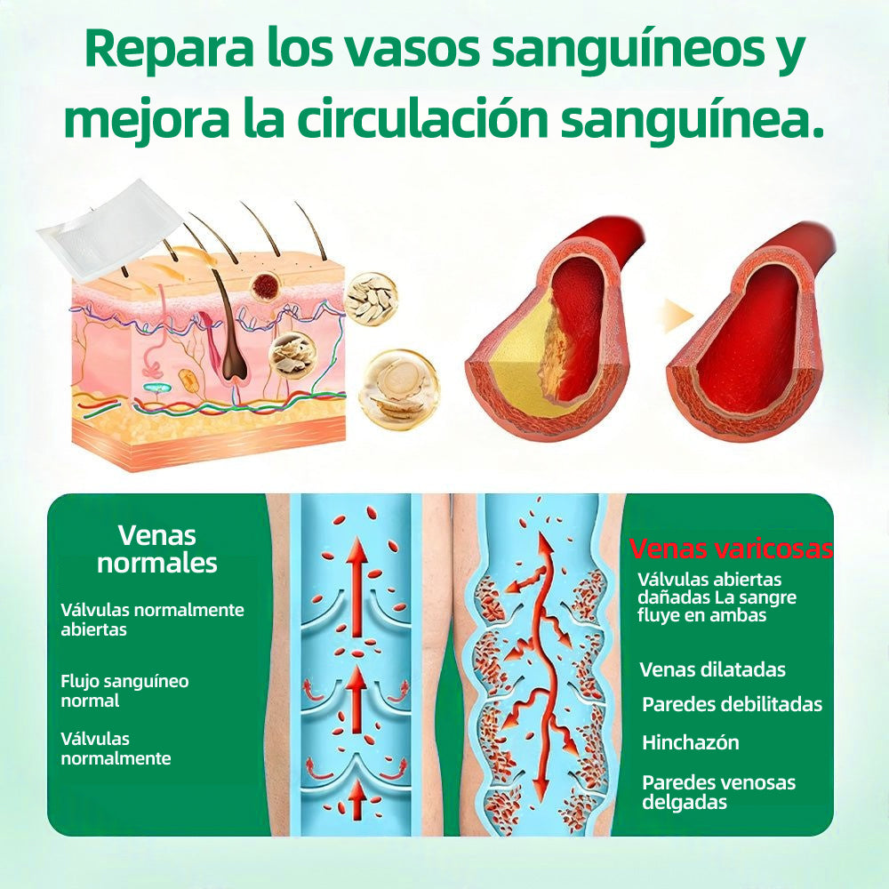 🦵🦵🦵Parche de Microagujas Healrize® VeinTarget —— Alivio Instantáneo, Resultados a Largo Plazo