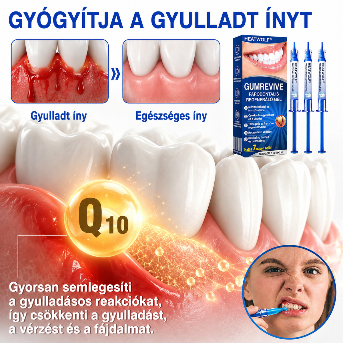 🇭🇺👨‍⚕️✅🦷 HEATWOLF® GumRevive – Parodontális helyreállító gél🦷✨3️⃣6️⃣