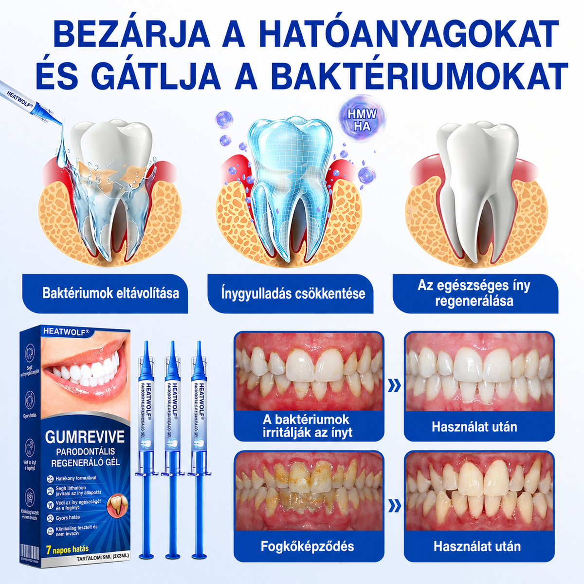 🇭🇺👨‍⚕️✅🦷 HEATWOLF® GumRevive – Parodontális helyreállító gél🦷✨3️⃣6️⃣