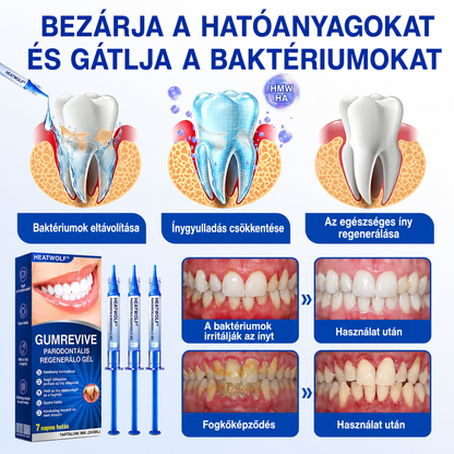 🇭🇺👨‍⚕️✅🦷 HEATWOLF® GumRevive – Parodontális helyreállító gél🦷✨3️⃣6️⃣