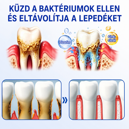 🇭🇺👨‍⚕️✅🦷 HEATWOLF® GumRevive – Parodontális helyreállító gél🦷✨3️⃣6️⃣