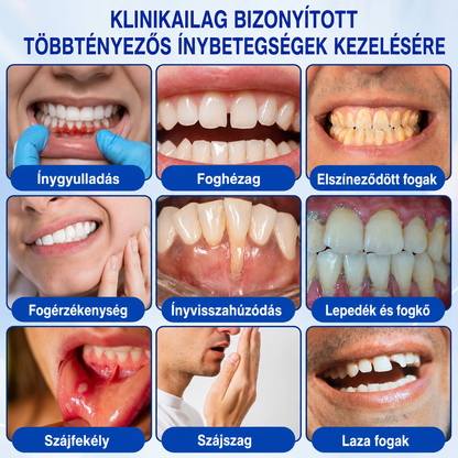 🇭🇺👨‍⚕️✅🦷 HEATWOLF® GumRevive – Parodontális helyreállító gél🦷✨3️⃣6️⃣