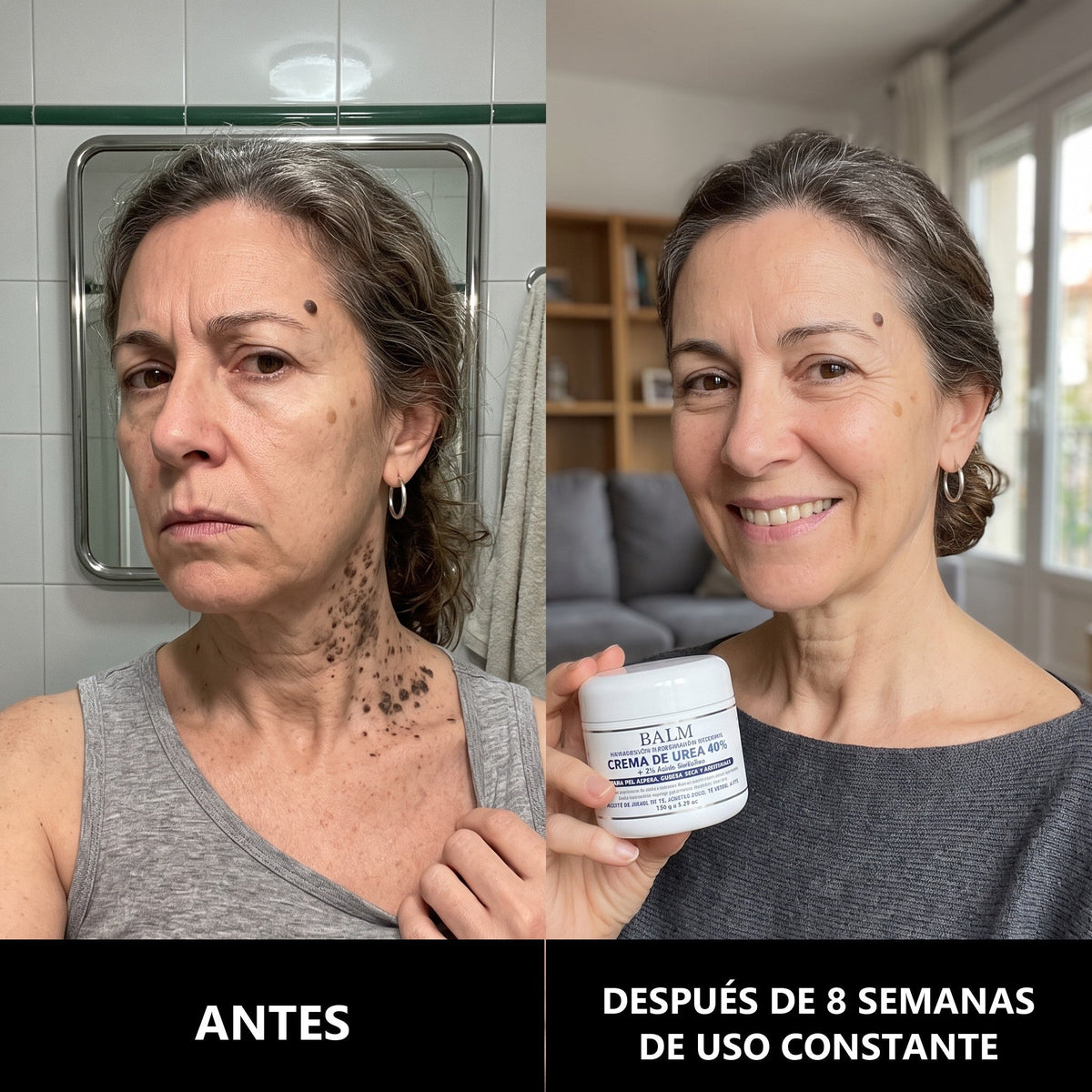 𝗖𝘂𝗿𝗲𝗩𝗶𝘃𝗼® — Crema de Urea al 40 %